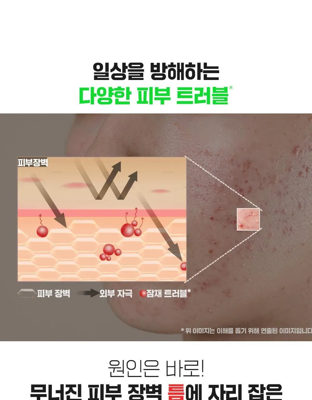 [단독기획/대용량] 파티온 노스카나인 트러블 크림 75ml 기획(+5ml) 상세페이지 14